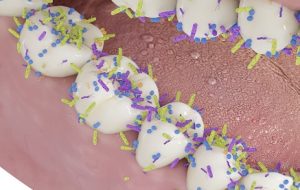 راز جلوگیری از پوسیدگی دندان ممکن است همین الان هم در دهان شما باشد راز جلوگیری از پوسیدگی دندان ممکن است همین الان هم در دهان شما باشد